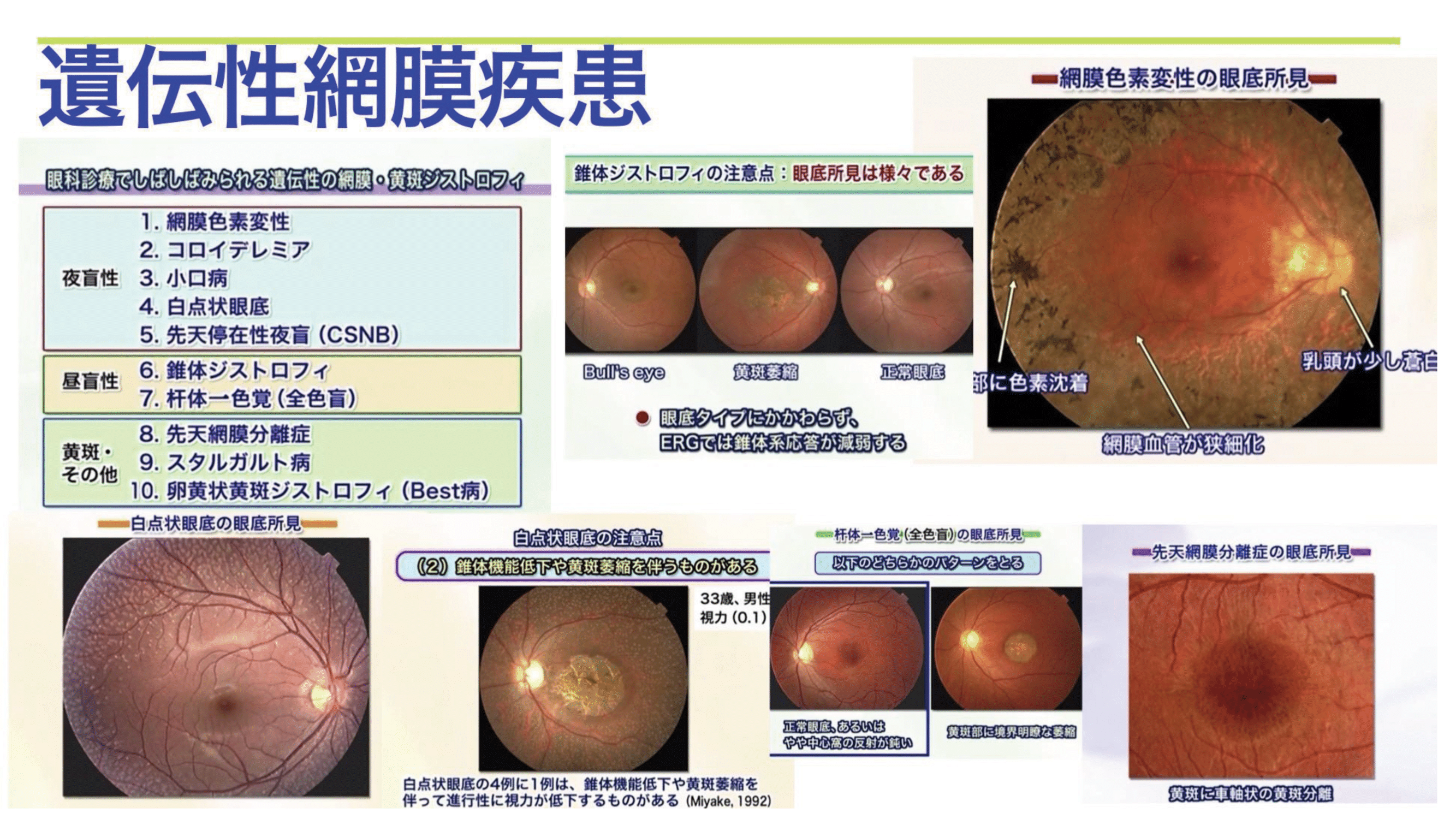 遺伝性眼底疾患-